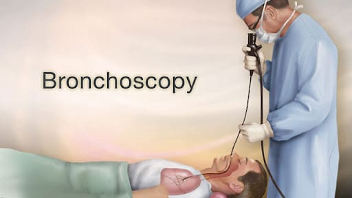 what is a bronchoscopy
