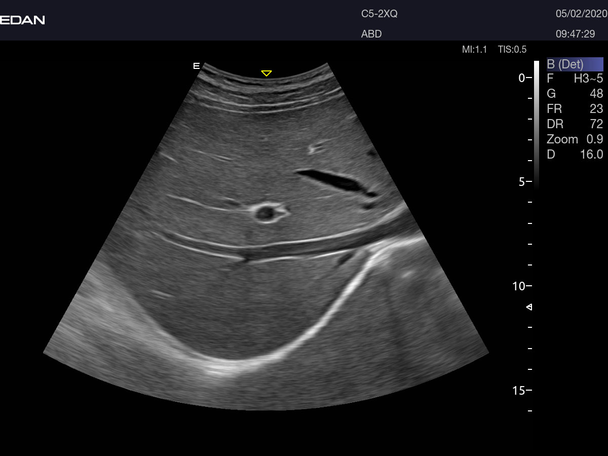 Diagnostic Ultrasound