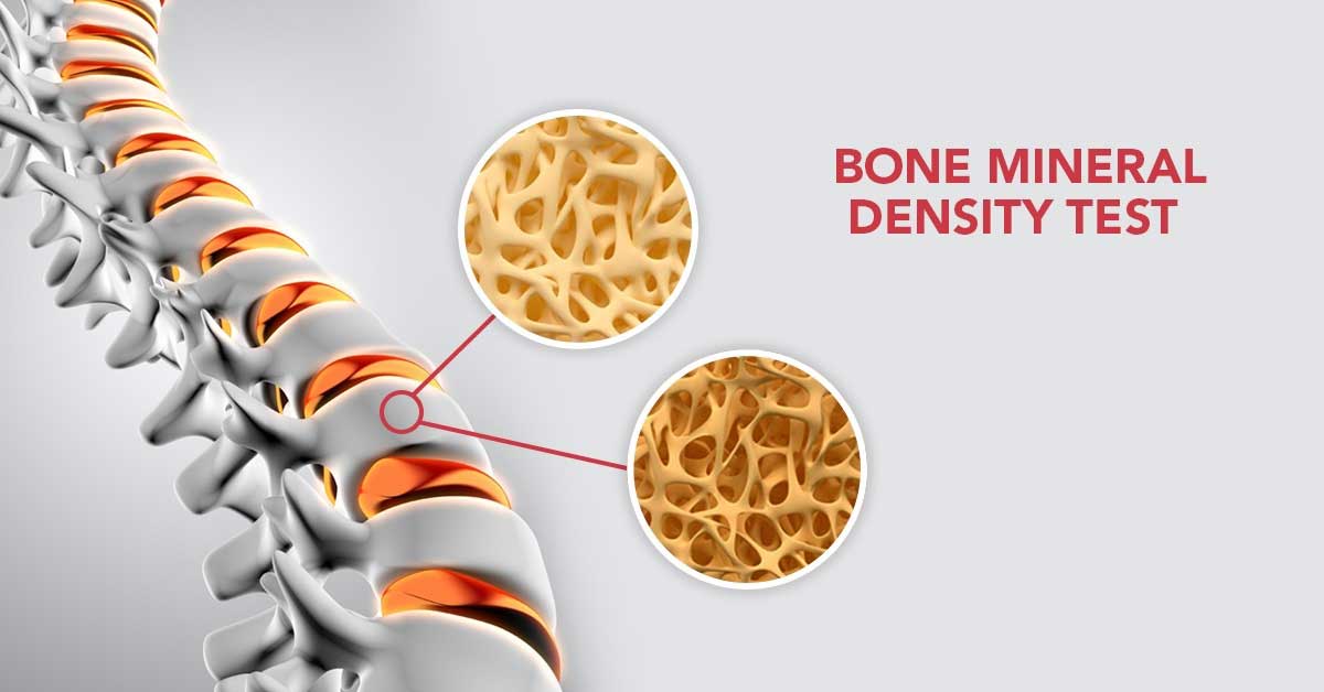 DEXA Scan