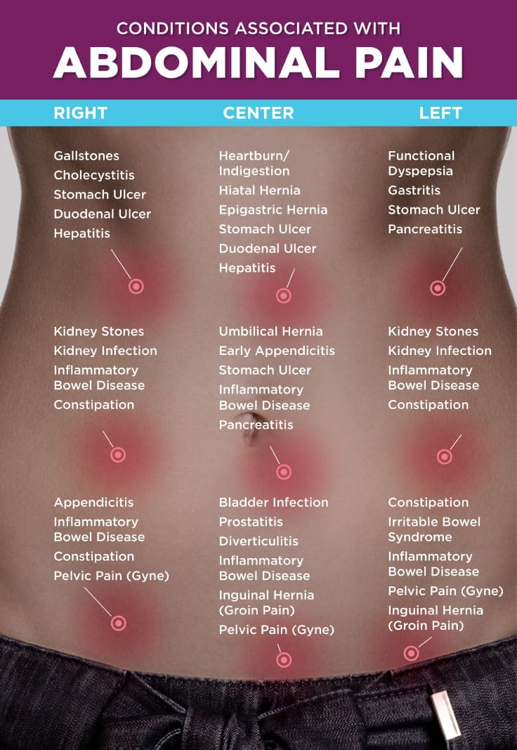 Abdominal Pain Causes By Location Stomach Anatomy And 50 Off