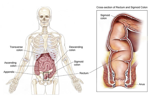 A Human Body Explain Flexible Sigmoidoscopy